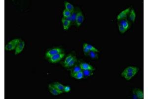 Immunofluorescent analysis of HepG2 cells using ABIN7147915 at dilution of 1:100 and Alexa Fluor 488-congugated AffiniPure Goat Anti-Rabbit IgG(H+L) (CLDN8 Antikörper  (AA 141-225))