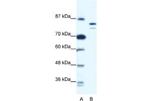 WB Suggested Anti-MCM8 Antibody Titration:  0. (MCM8 Antikörper  (N-Term))