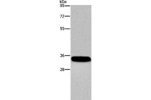 Western Blot analysis of Human normal lung tissue using CA4 Polyclonal Antibody at dilution of 1:300 (CA4 Antikörper)