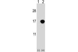 Western blot analysis of CDKN2B antibody and 293 cell lysate either nontransfected (Lane 1) or transiently transfected (2) with the CDKN2B gene. (CDKN2B Antikörper  (AA 102-130))