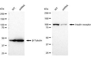 Western blotting analysis using Insulin receptor antibody (ABIN7799045).