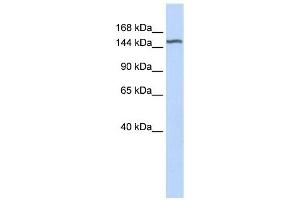 DGKH antibody used at 1 ug/ml to detect target protein. (DGKH Antikörper  (Middle Region))