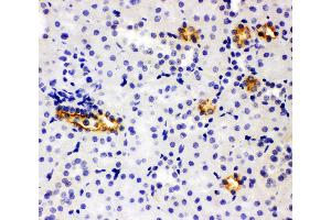 Anti-SLC12A1 antibody, IHC(P) IHC(P): Rat Kidney Tissue (SLC12A1 Antikörper  (N-Term))