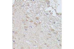 Immunohistochemistry (IHC) image for anti-Protein Phosphatase 2, Regulatory Subunit B', delta (PPP2R5D) (AA 450-550) antibody (ABIN7269690)