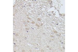 Immunohistochemistry of paraffin-embedded rat brain using PP2A-B56δ/PR61δ/PP2A-B56δ/PR61δ/PPP2R5D antibody (ABIN7269690) at dilution of 1:100 (40x lens). (PPP2R5D Antikörper  (AA 450-550))