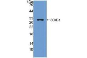 Detection of Recombinant CMA1, Mouse using Polyclonal Antibody to Chymase 1, Mast Cell (CMA1)