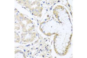 Immunohistochemistry of paraffin-embedded human gastric using INPP5K antibody at dilution of 1:100 (x40 lens). (INPP5K Antikörper)