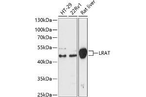 Western blot analysis of extracts of various cell lines, using Lrat antibody (ABIN6132017, ABIN6143311, ABIN6143314 and ABIN6217073) at 1:3000 dilution. (LRAT Antikörper  (AA 31-150))