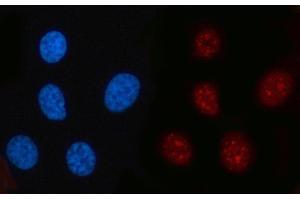 IF analysis of RFC2 using anti-RFC2 antibody (ABIN7601644).