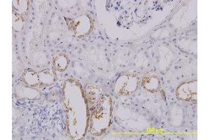 Image no. 1 for anti-Solute Carrier Family 25 (Mitochondrial Carrier, Oxoglutarate Carrier), Member 11 (SLC25A11) (AA 1-315) antibody (ABIN599038) (SLC25A11 Antikörper  (AA 1-315))