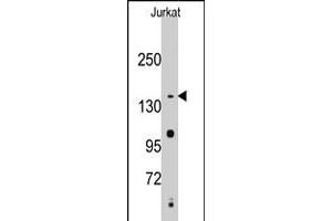 Western blot analysis of SMC2 polyclonal antibody  in Jurkat cell line lysates (35 ug/lane). (SMC2 Antikörper  (C-Term))