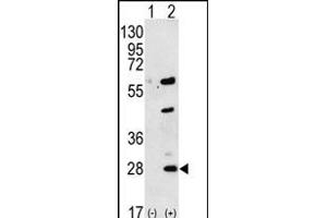 Western blot analysis of GREM1 (arrow) using rabbit polyclonal GREM1 Antibody (C-term) (ABIN656181 and ABIN2845510). (GREM1 Antikörper  (C-Term))