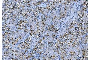 IHC analysis of FMRP/FMR1 using anti-FMRP/FMR1 antibody (ABIN3042398).