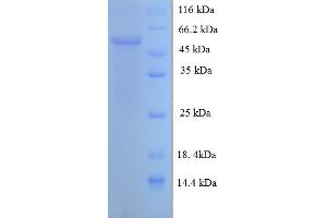 SDS-PAGE (SDS) image for Regucalcin (RGN) (AA 1-299), (full length) protein (His-SUMO Tag) (ABIN5710252)