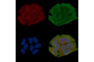 ABIN7096934 and ABIN7101000 staining Hela cells(30 min of UV treatment) by IF/ICC.