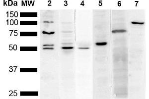 Western Blot analysis of Human Cervical cancer cell line (HeLa) lysate showing detection of Multiple KDEL protein using Mouse Anti-KDEL Monoclonal Antibody, Clone 2C1 (ABIN5650522). (KDEL Antikörper  (N-Term) (Biotin))