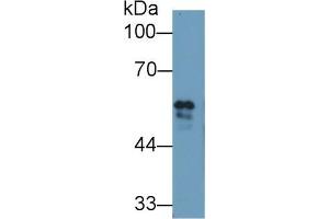 Western blot analysis of Cow Serum, using Cow FGb Antibody (1 µg/ml) and HRP-conjugated Goat Anti-Rabbit antibody ( (Fibrinogen beta Chain Antikörper  (AA 49-495))