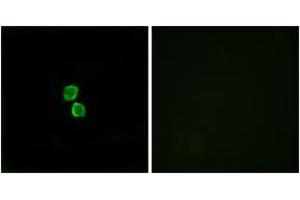 Immunofluorescence analysis of MCF7 cells, using CKLF1 Antibody. (CKLF Antikörper  (AA 120-169))
