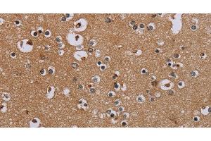 Immunohistochemistry of paraffin-embedded Human brain tissue using IFRD1 Polyclonal Antibody at dilution 1:40