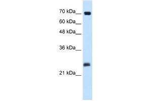 WB Suggested Anti-SERTAD1 Antibody Titration:  0.