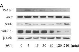 Western Blotting (WB) image for anti-SET Domain Containing 2 (SETD2) (AA 803-1103) antibody (ABIN1682666)
