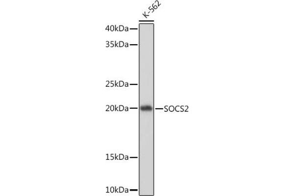 SOCS2 Antikörper