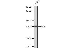 Western blot analysis of extracts of K-562 cells, using SOCS2 Rabbit mAb (ABIN7270641) at 1:1000 dilution. (SOCS2 Antikörper)