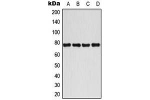 Western blot analysis of BMX (pY40) expression in MCF7 IL1b-treated (A), Jurkat CD3-treated (B), Raw264. (BMX Antikörper  (N-Term, pTyr40))