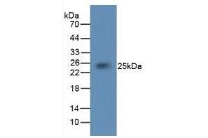 Western Blotting (WB) image for anti-Coagulation Factor III (thromboplastin, Tissue Factor) (F3) (AA 33-292) antibody (ABIN7426838)
