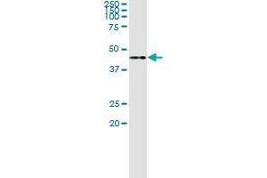 Immunoprecipitation of TWF1 transfected lysate using rabbit polyclonal anti-TWF1 and Protein A Magnetic Bead (TWF1 (Human) IP-WB Antibody Pair)