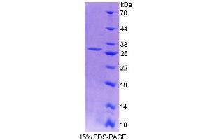 SDS-PAGE (SDS) image for Actin Filament Associated Protein 1 (AFAP1) (AA 352-572) protein (His tag) (ABIN4989129) (AFAP Protein (AA 352-572) (His tag))