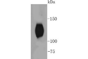 Mouse brain lysates, probed with TrkB(Y817) (2A1 ) Monoclonal Antibody  at 1:1000 overnight at 4˚C. (TRKB Antikörper  (pTyr817))