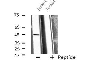 Western blot analysis of extracts from Jurkat cells, using BMP10 antibody. (BMP10 Antikörper  (Internal Region))
