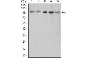 Western Blotting (WB) image for anti-5'-3' Exoribonuclease 2 (XRN2) (AA 398-547) antibody (ABIN5855738) (XRN2 Antikörper  (AA 398-547))