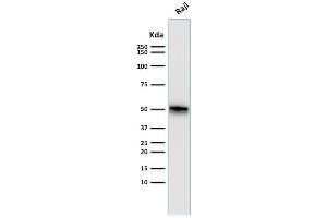 Western Blot Analysis of Raji cell lysate using CD79a Monoclonal Antibody (SPM550). (CD79a Antikörper  (AA 202-216))