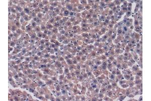 Used in DAB staining on fromalin fixed paraffin-embedded Heart tissue (FKBP3 Antikörper  (AA 2-224))