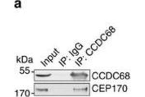 CCDC68 interacts with CEP170 and is localized at the centrosomes. (CCDC68 Antikörper)