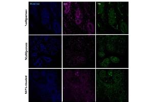 Immunohistochemical detection of progesterone receptor (PR) and estradiol receptor (ER-a) in the basal region of the endometrium in uteri of nulliparous, multiparous and MPA-treated dogs. (Progesterone Receptor Antikörper  (AA 501-600) (Alexa Fluor 488))