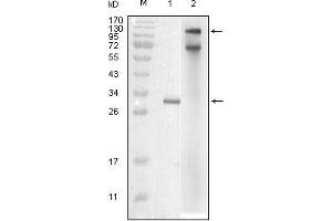 Western blot analysis using IKBKE mouse mAb against truncated IKBKE recombinant protein (1) and full-length IKBKE(aa1-716)-hIgGFc transfected COS7 cell lysate (2). (IKKi/IKKe Antikörper)