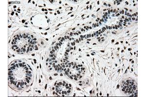 Immunohistochemical staining of paraffin-embedded breast tissue using anti-SCYL3 mouse monoclonal antibody. (SCYL3 Antikörper)