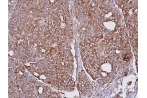 IHC-P Image Immunohistochemical analysis of paraffin-embedded NCI-N87 xenograft, using SEC31A, antibody at 1:100 dilution.