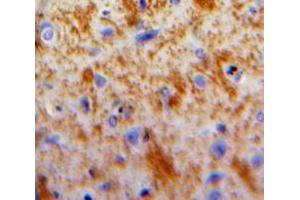 Used in DAB staining on fromalin fixed paraffin-embedded Brain tissue (DKK2 Antikörper  (AA 159-258))