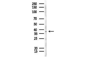 Western blot analysis of lysates from Rat liver, using ELSPBP1 Antibody at 1/1000 dilution.