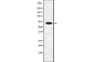 Western blot analysis of Rab11-FIP4 using HepG2 whole cell lysates (RAB11FIP4 Antikörper  (Internal Region))