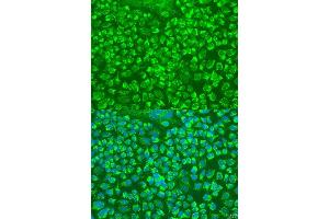 Immunofluorescence analysis of U2OS cells using GZMA antibody. (GZMA Antikörper  (AA 29-262))