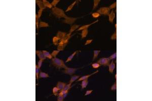 Immunofluorescence (IF) image for anti-Ubiquilin 2 (UBQLN2) (AA 1-150) antibody (ABIN6149859)