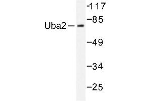 Image no. 1 for anti-SUMO1 Activating Enzyme Subunit 2 (UBA2) antibody (ABIN271971) (UBA2 Antikörper)