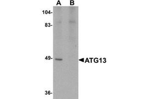 Western blot analysis of ATG13 in rat heart tissue lysate with ATG13 antibody at 1 μg/ml in (A) the absence and (B) the presence of blocking peptide.