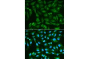 Immunofluorescence analysis of MCF7 cell using SORD antibody. (SORD Antikörper  (AA 1-357))