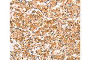 Immunohistochemistry (IHC) image for anti-Toll-Like Receptor 3 (TLR3) antibody (ABIN2422741) (TLR3 Antikörper)